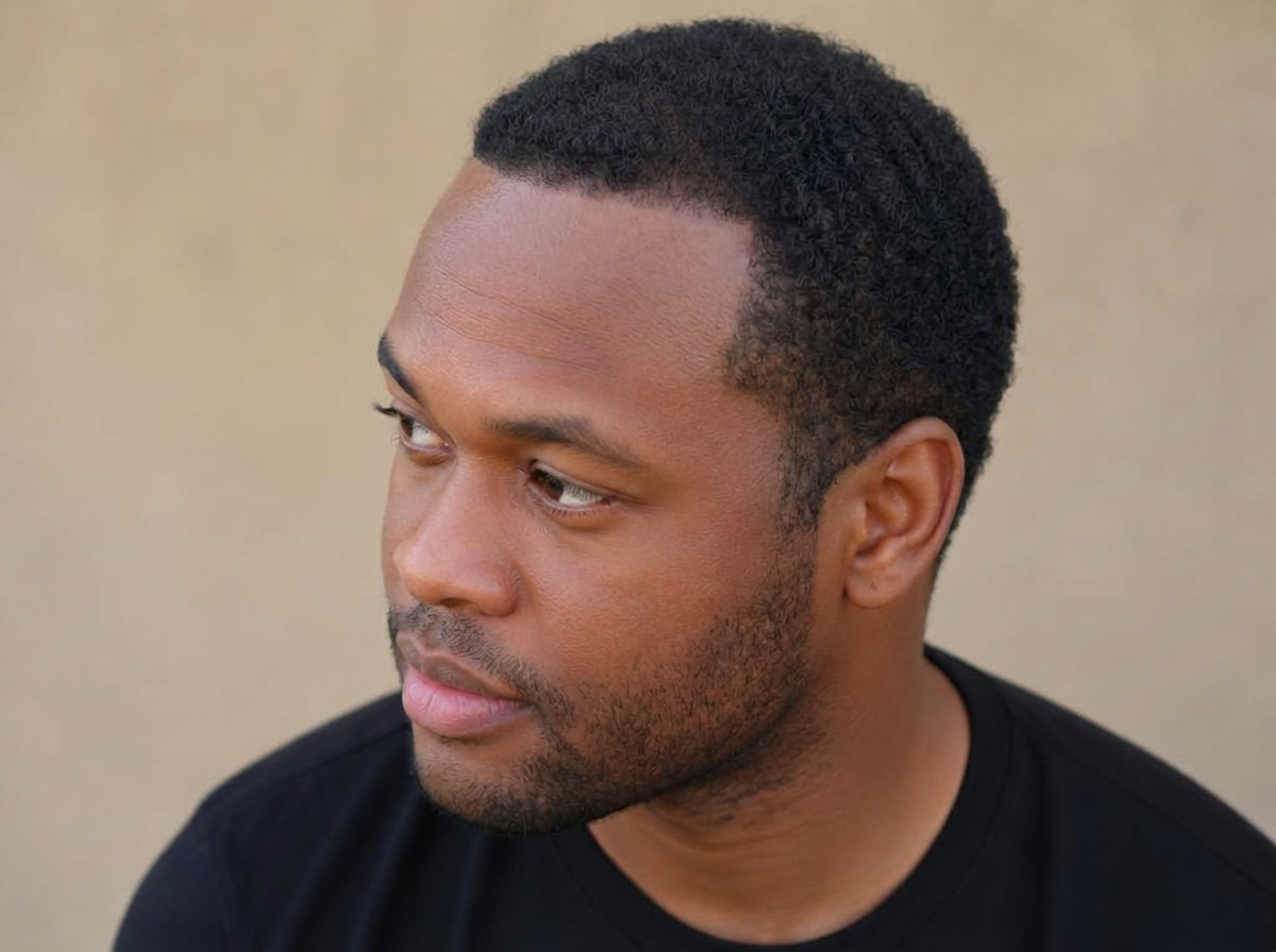 Same man after treatment with a restored, fuller hairline